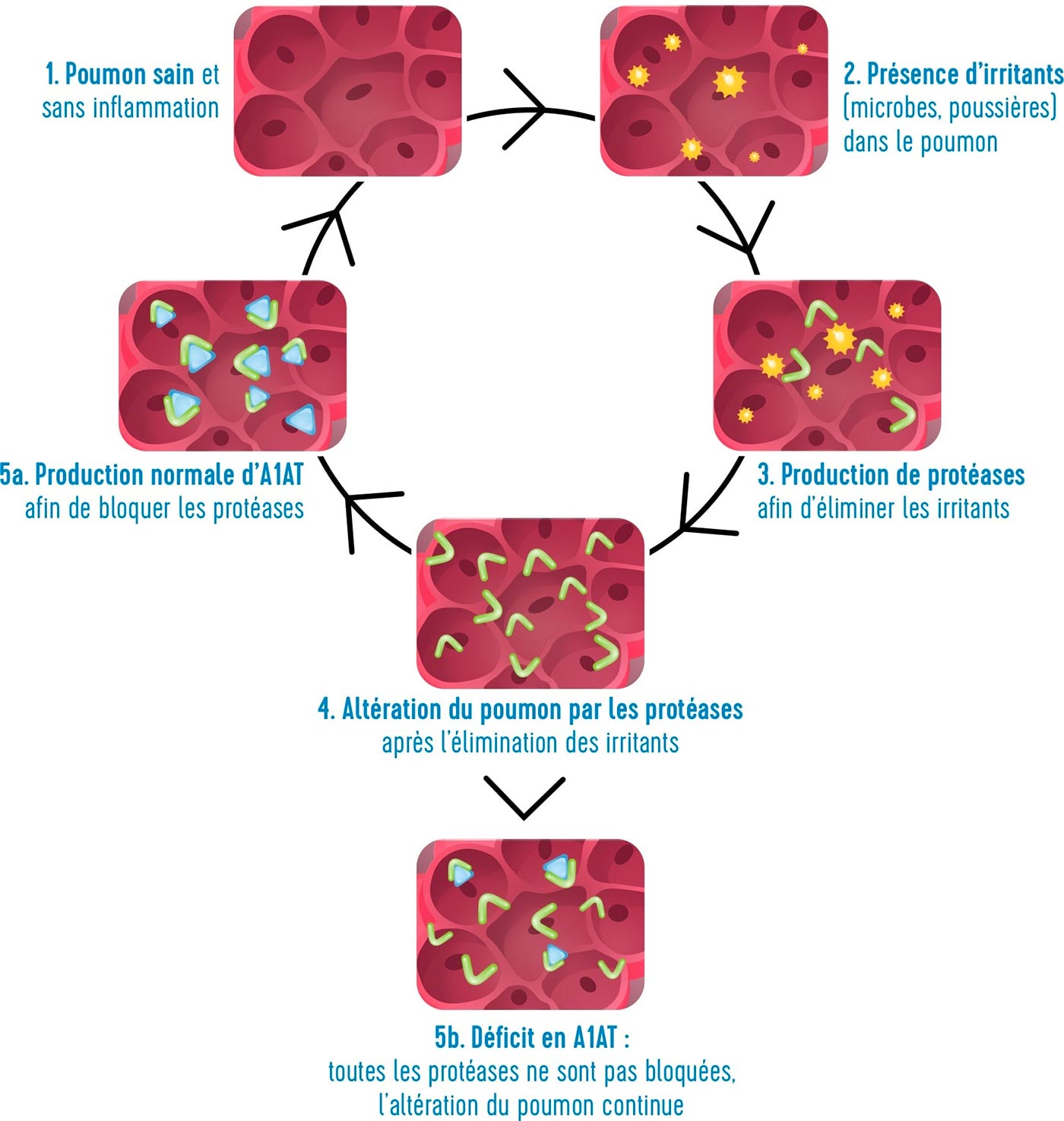 Rôle de l'alpha 1 antitrypsine - Daat et vous